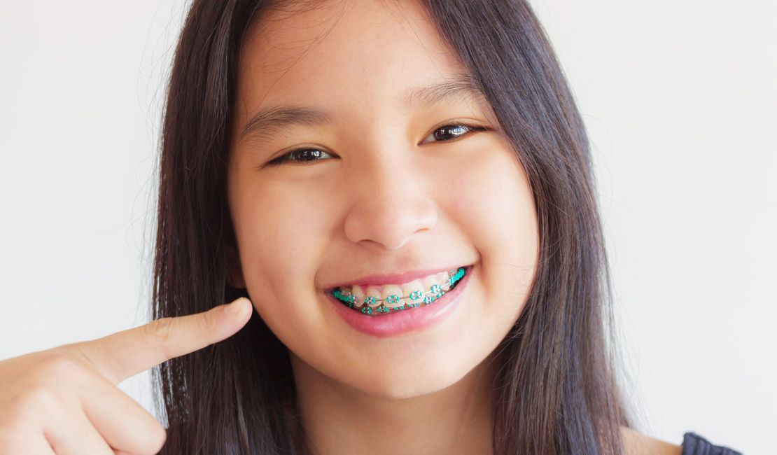 iSmile Dental Home | Orthodontist in Taguig, Philippines